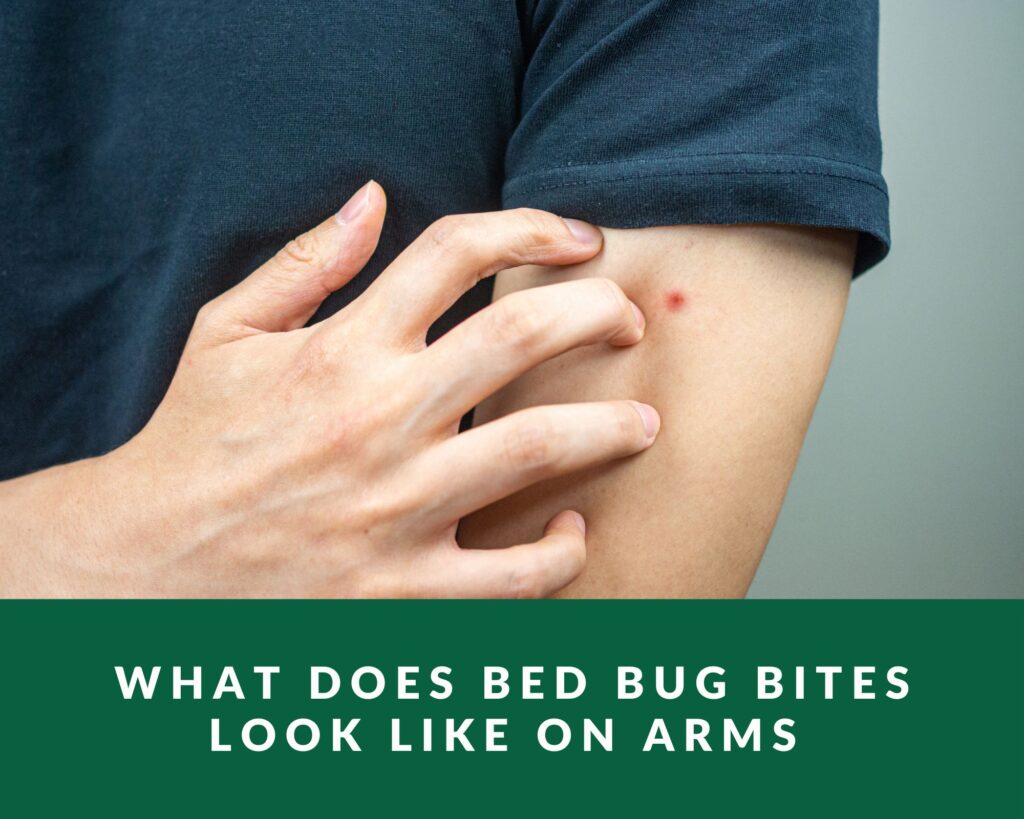 What bed bug bites look like on arms 
