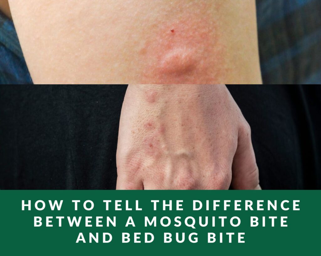 how to tell difference between mosquito bite and bed bug bite
