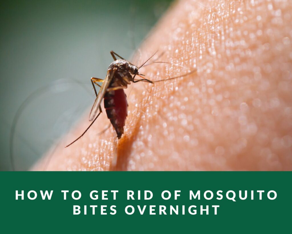 Does Ice Make Mosquito Bites Go Away