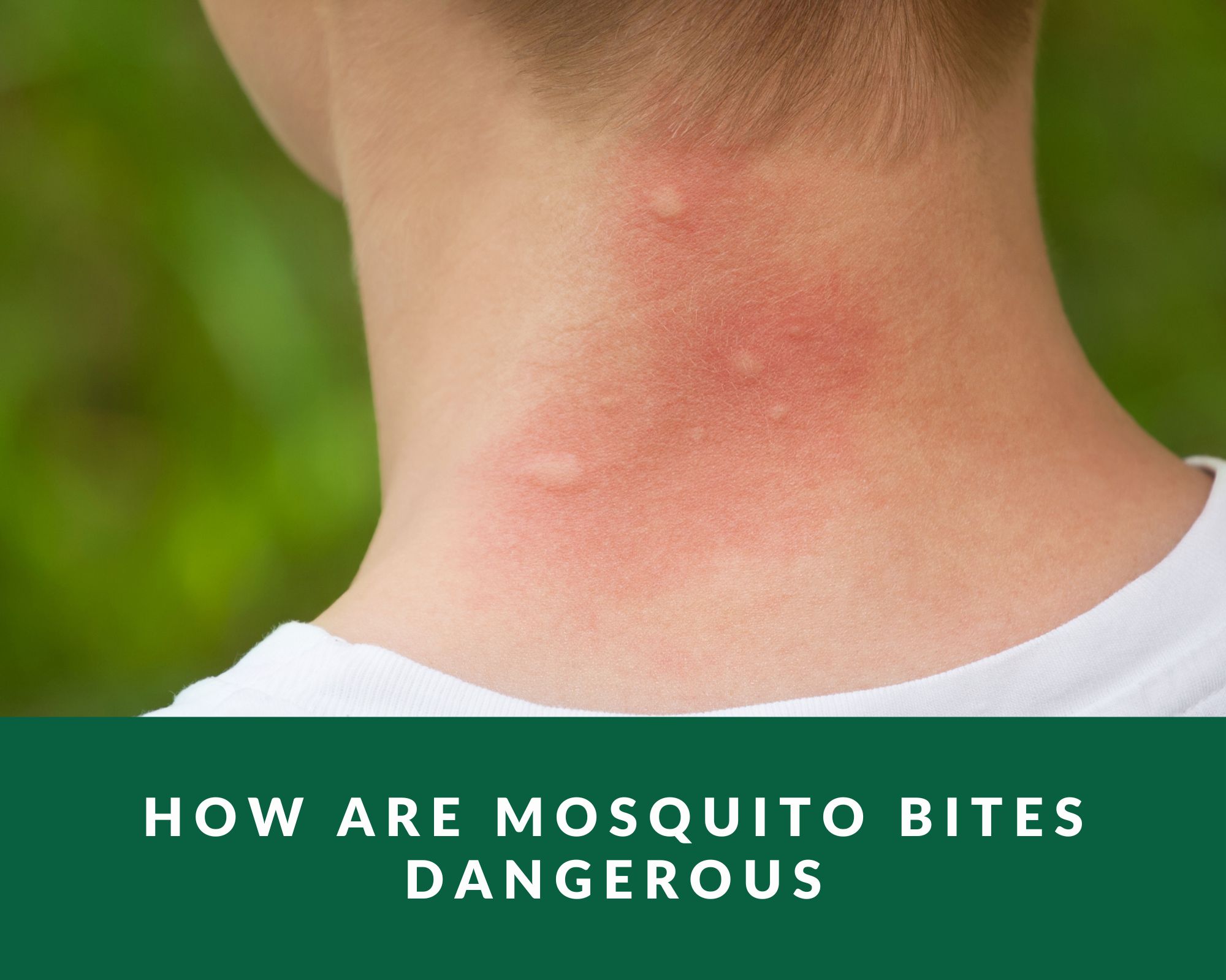 How are mosquito bites dangerous