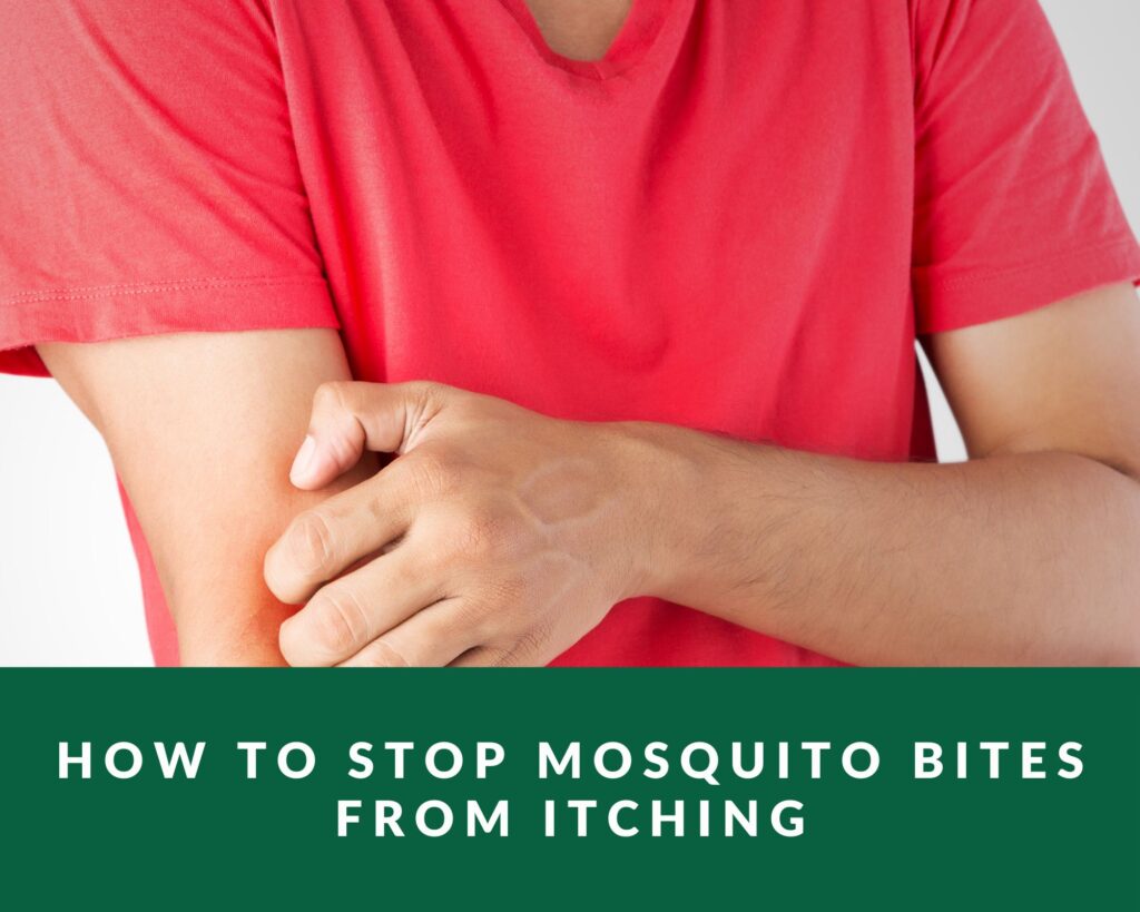 how to Stop Mosquito Bites from Itching