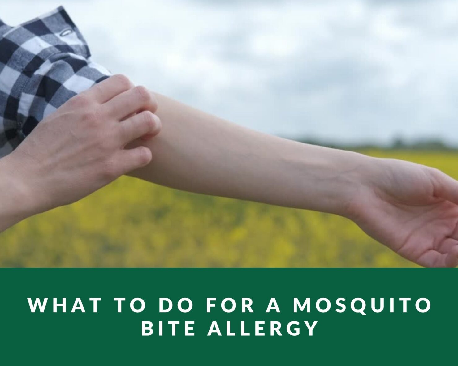 what to do for a mosquito bite allergy